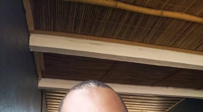 ⚫️⚫️ Abusé sexuellement par un cousin paternel à l’age de 7ans Mahot Serge Wilfried brise le silence.Un témoignage choquant: